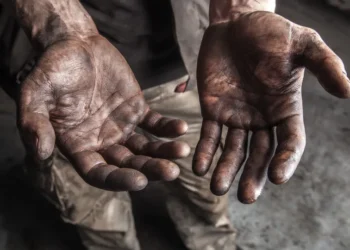 Escravizado tatuado com iniciais do patrão pode receber R$ 1,3 milhão