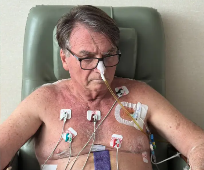 Bolsonaro passa hoje por cirurgia de hérnia; entenda o procedimento e os riscos