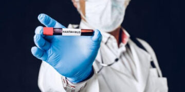 Hantavírus: diagnóstico precoce ajuda a diferenciar doença de outras infecções febris e ampliar cuidado adequado