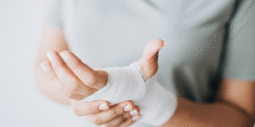 Curso de Fisioterapia da Unijorge realiza atendimento gratuito a pacientes queimados